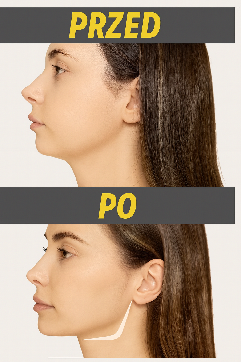 URZĄDZENIE DO ĆWICZENIA SZCZĘKI I MIĘŚNI TWARZY